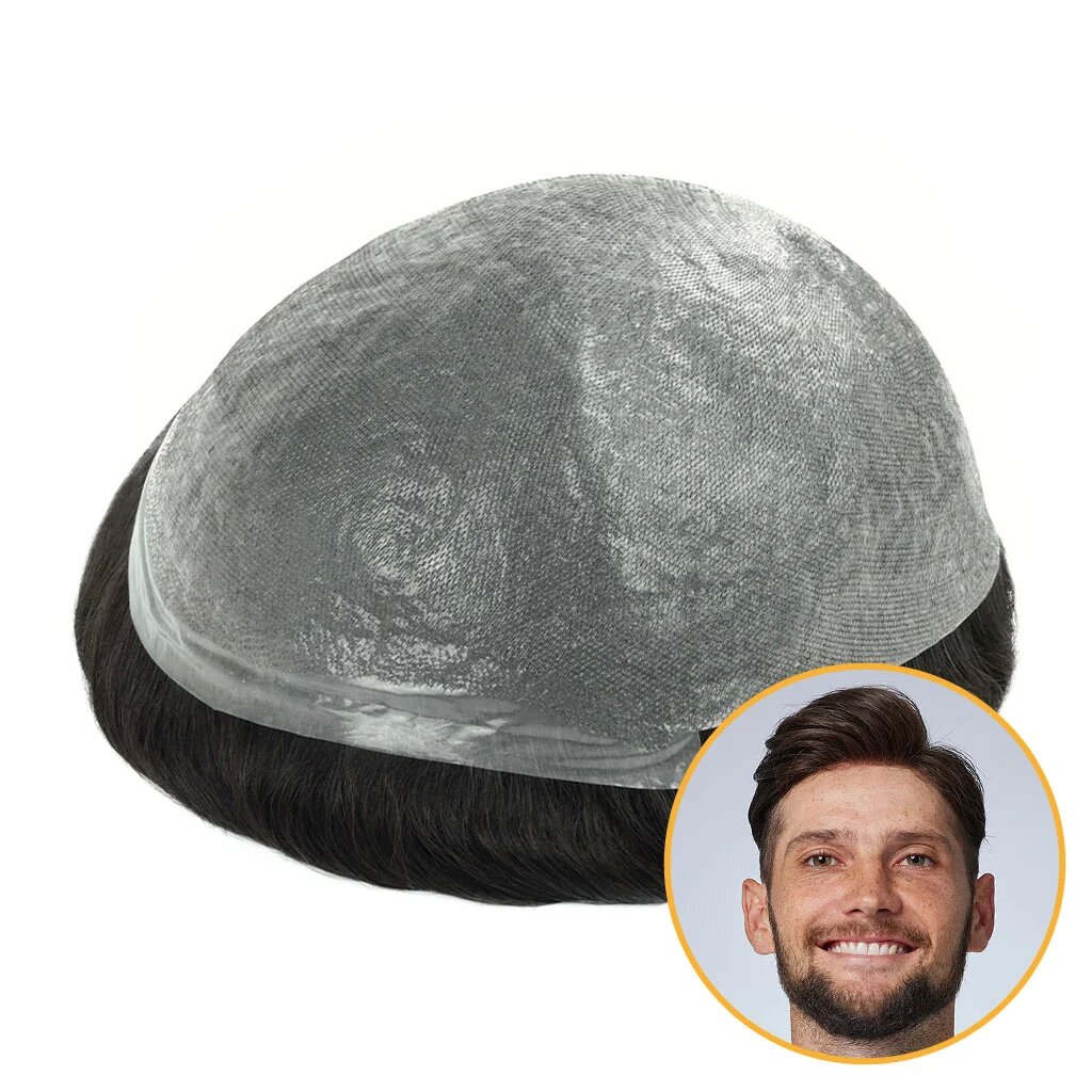 TS-V: V-Loop Poly Thin Skin